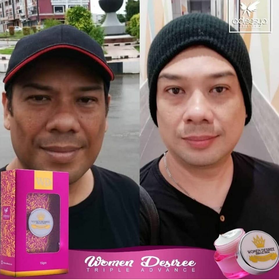 Skin Care Anti-Aging WDTA 15gm – Look fresh,look beauty,look young with WD