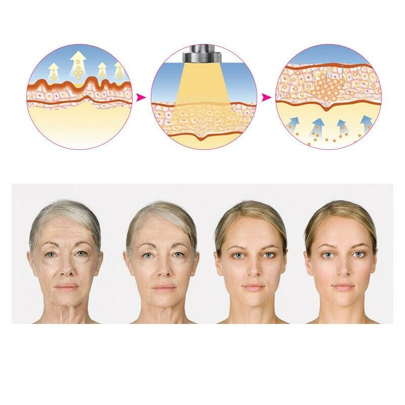 High Quality 2in1 Wrinkle Removal Anti-Aging Machine Skin Tightening Instrument