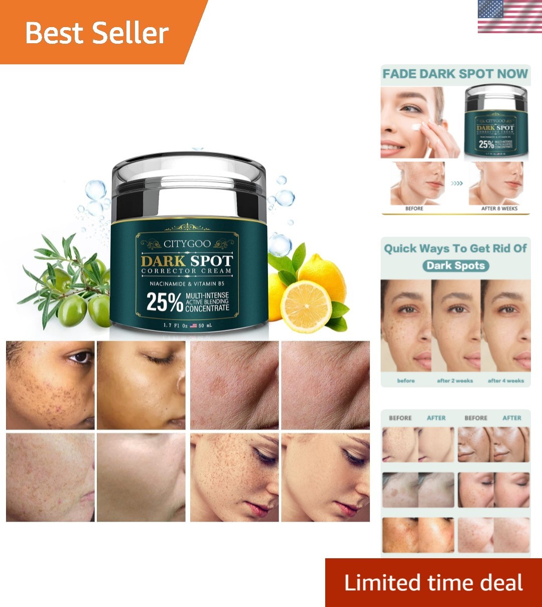 Dark Spot Remover for Face: Dark Spot Corrector Cream – Enriching Skin Care F…