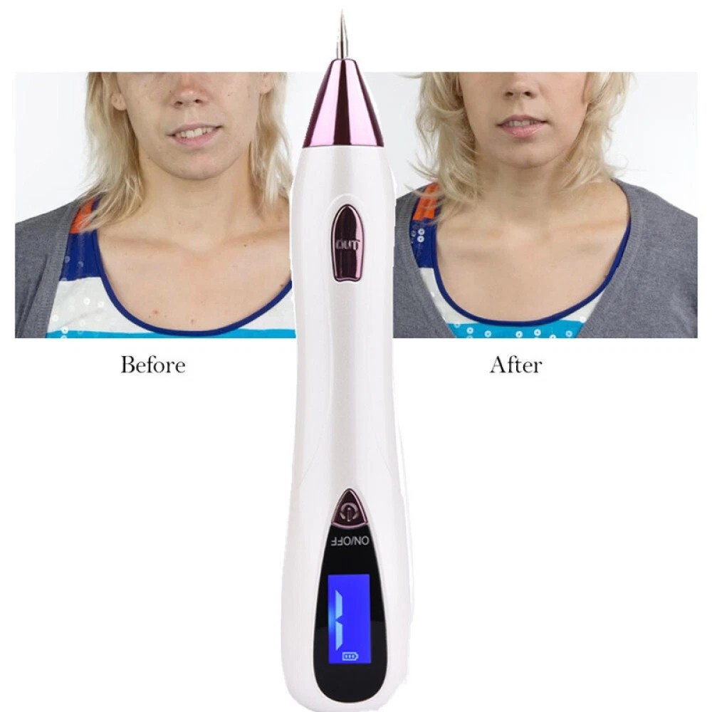 Anti-Aging Laser Plasma Pen Mole Removal Dark Spot Remover Skin Wart Tag Tattoo
