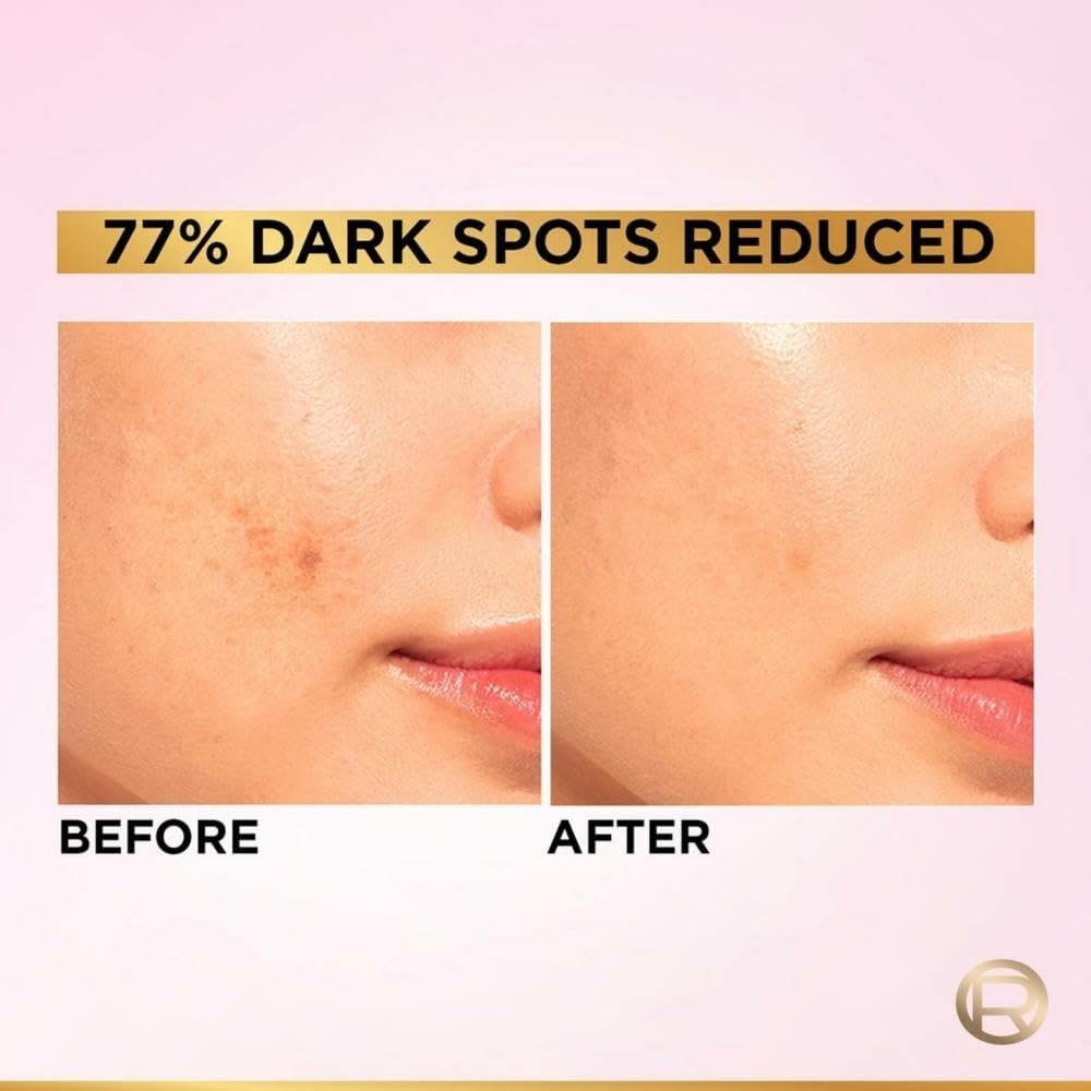 L’Oreal Paris Glycolic Bright 8% [Melasyl + Niacinamide] Face Serum 15ml