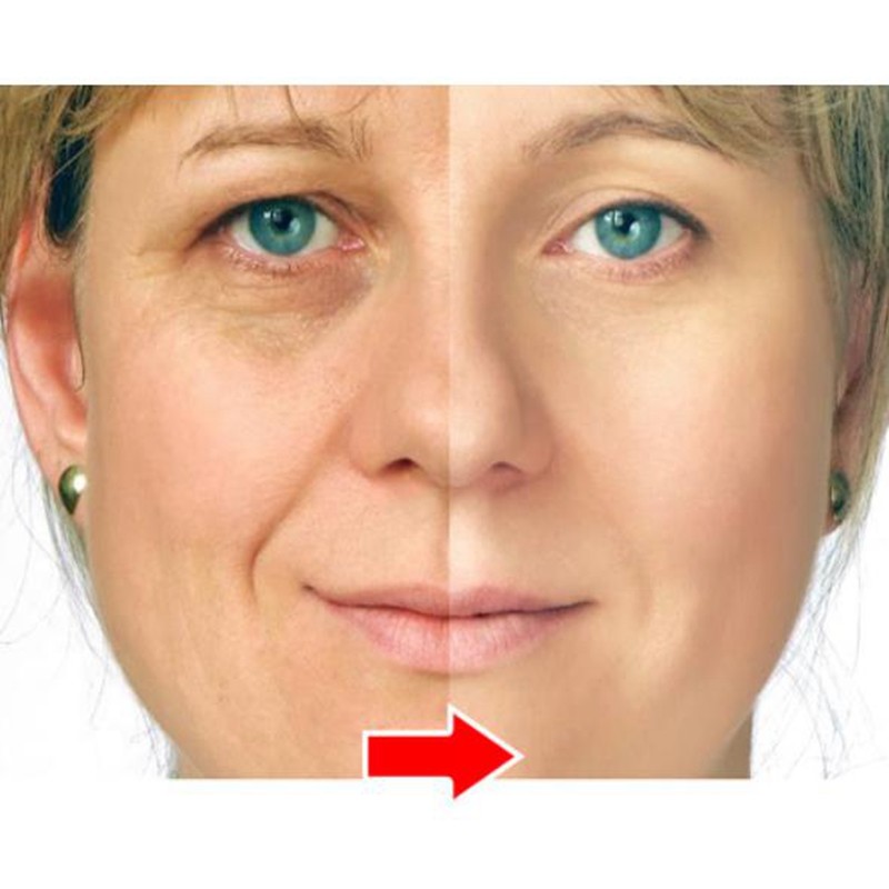 anti aging supplements – ACAI BERRY – ANTI-WRINKLE COMBO 2B – collagen supplemen