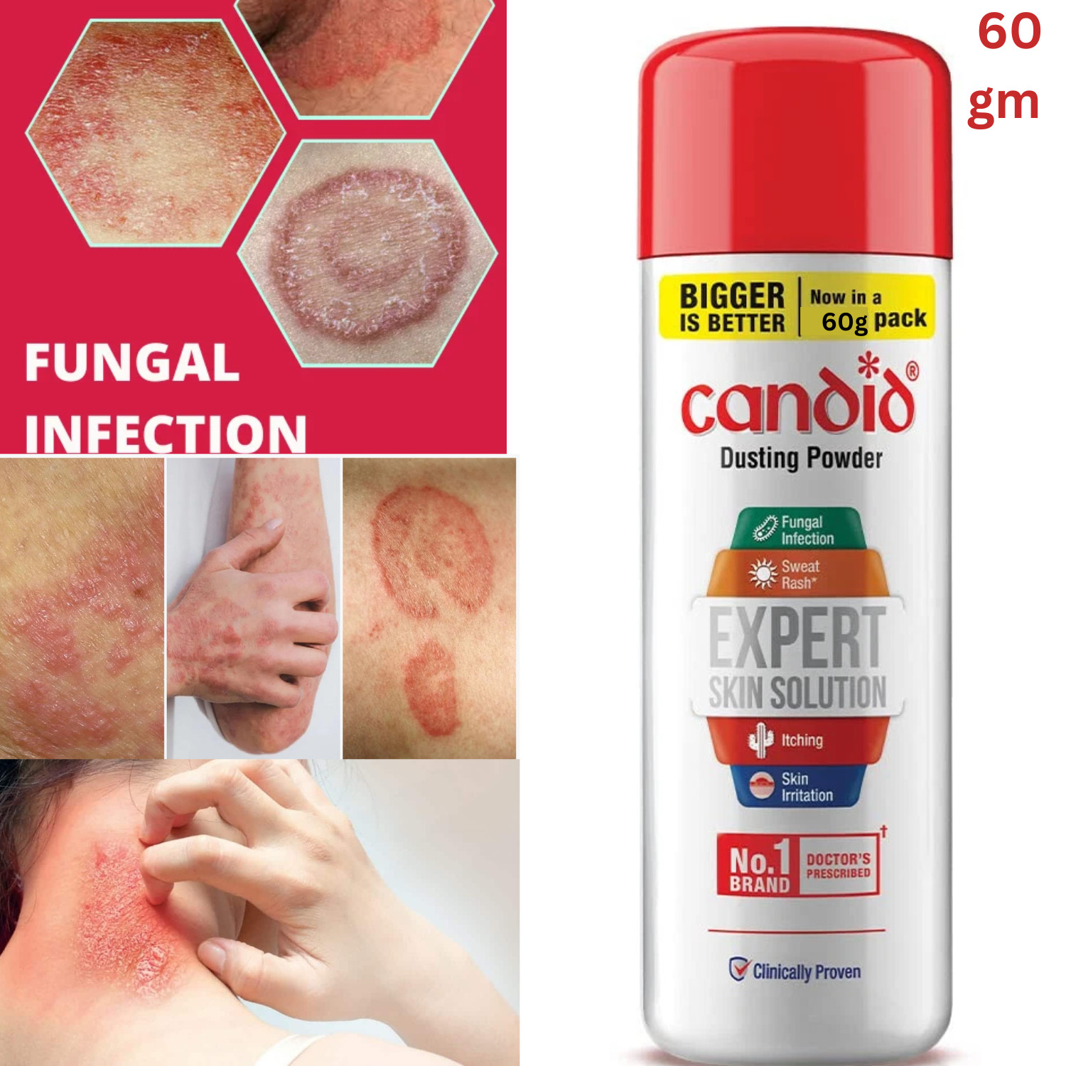 Candid Dusting Powder 1 Expert Solution for all Skin problem For Skin care-60gm