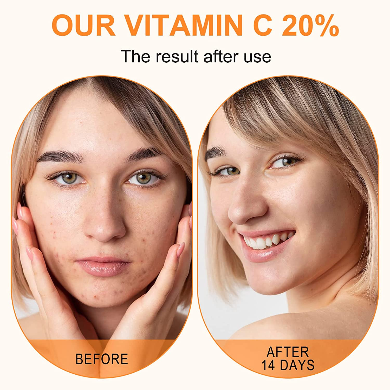 Premium 20% Vitamin C Serum for Face with Hyaluronic Acid