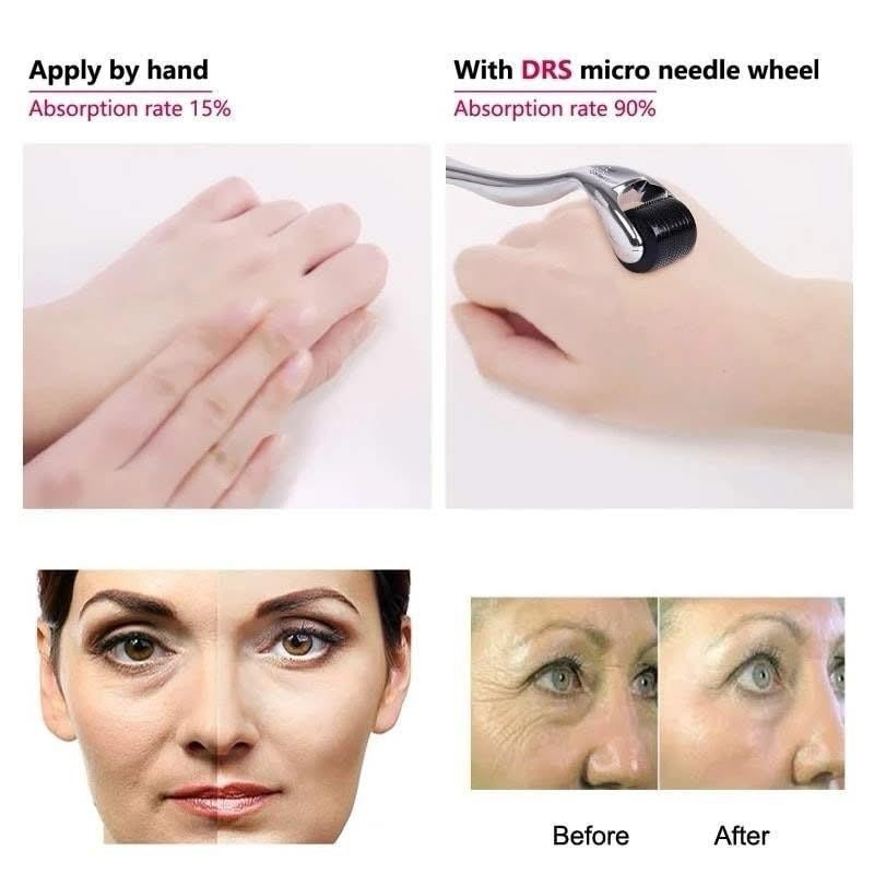 derma roller