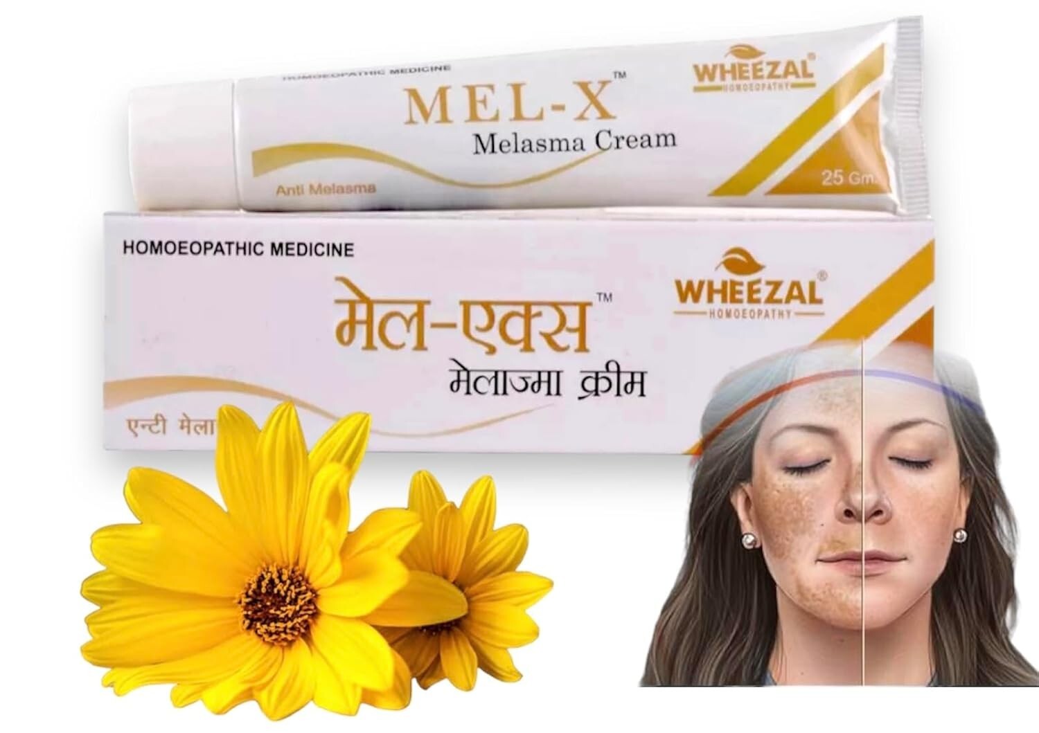 Wheezal Mel-X Melasma Cream – 25 gm for Skin Pigmentation Free Shipping